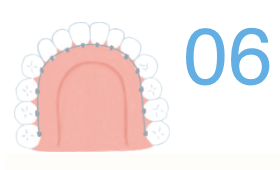 06