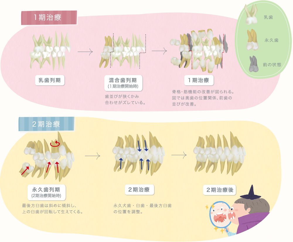 1期治療と2期治療