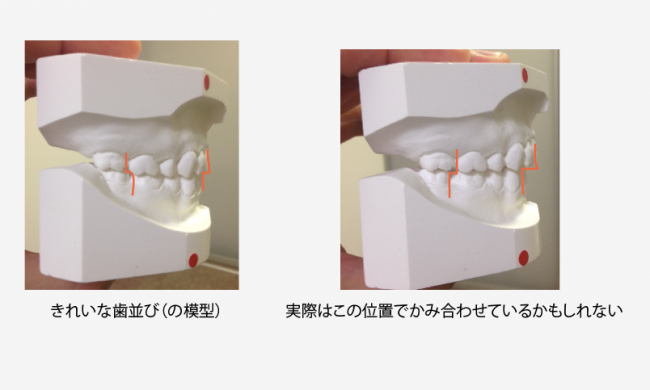 名称未設定 15