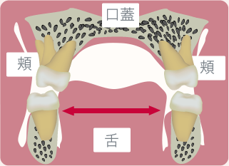 低位舌/舌の運動不良　イメージ