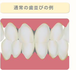 通常の歯並びの例