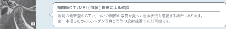 顎関節ＣＴ/MRI (依頼)撮影による確認／当院の最新型のＣＴで、あごの関節の写真を撮って進捗状況を確認する場合もあります。歯一本撮るためのレントゲン写真と同等の放射線量で判別可能です。
