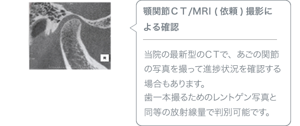 顎関節ＣＴ/MRI (依頼)撮影による確認／当院の最新型のＣＴで、あごの関節の写真を撮って進捗状況を確認する場合もあります。歯一本撮るためのレントゲン写真と同等の放射線量で判別可能です。