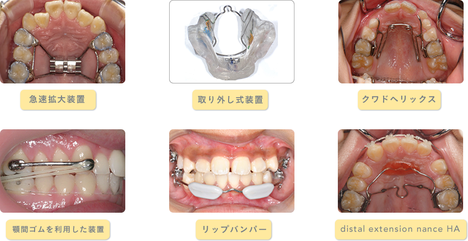 その他装置　イメージ