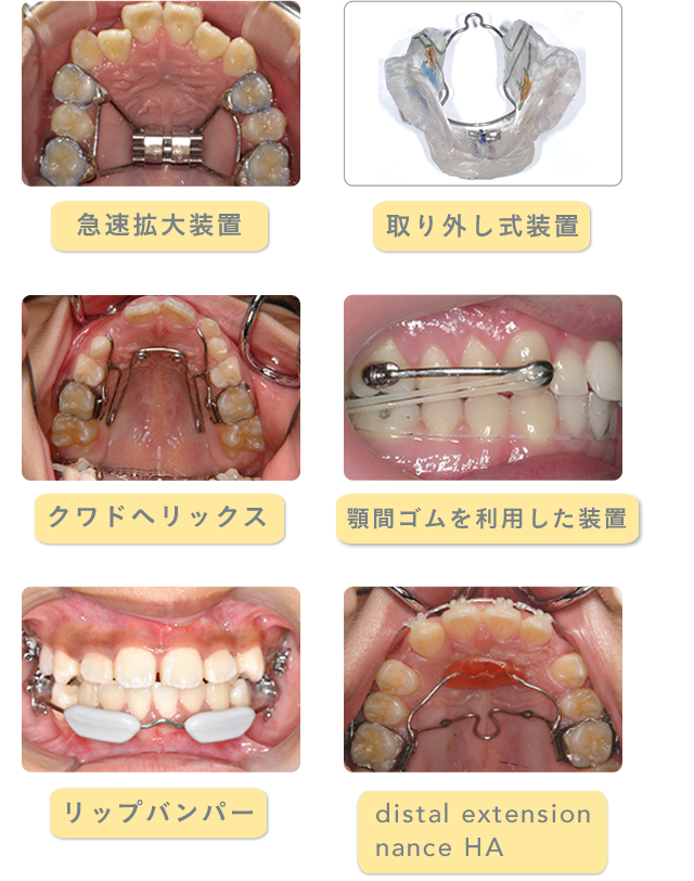 その他装置　イメージ